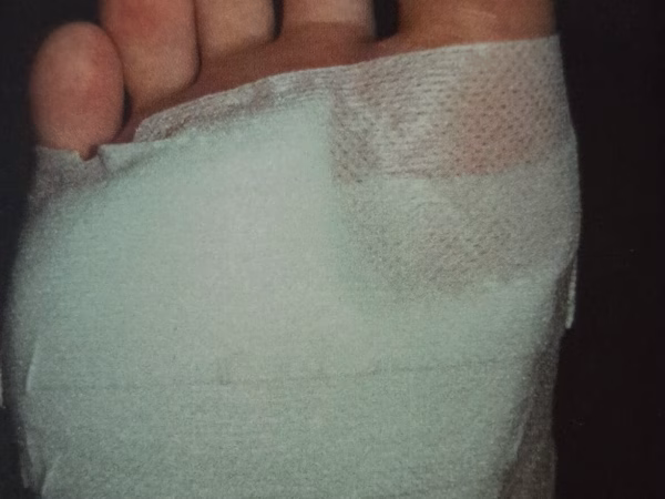 Vilttherapie