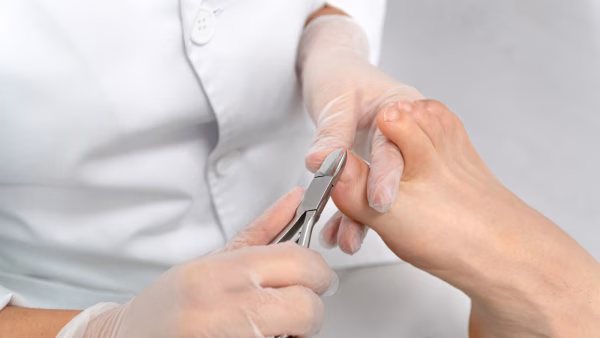 teennagels worden geknipt - basis pedicure