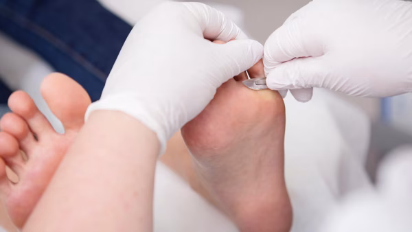 voet behandeling - basis pedicure