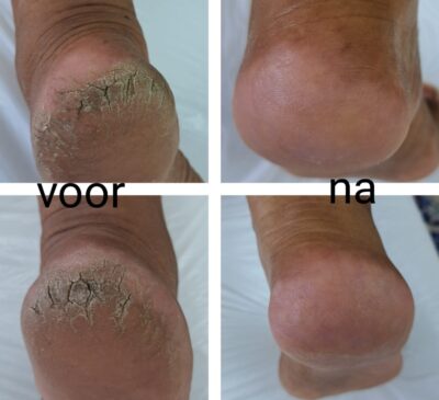 Onze galerij