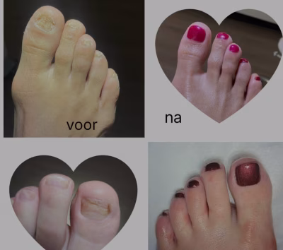 Onze galerij